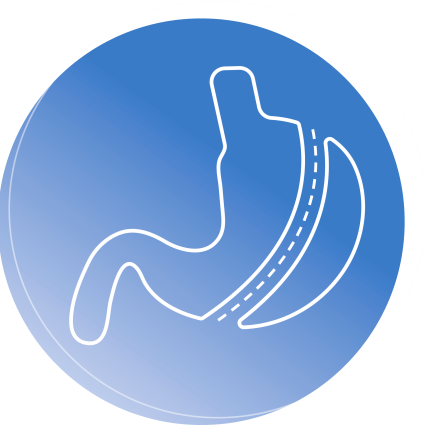 stomach_surgery_img